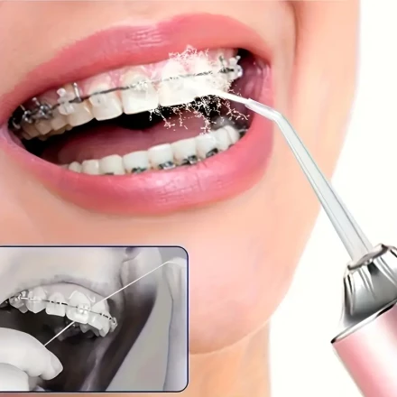 Portable Water Flosser with 4 Nozzles - USB Rechargeable Tooth Washer, Ergonomic Handle, Multiple Modes, Suitable for Home Use