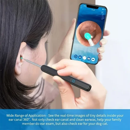USB Rechargeable Ear Wax Removal Kit with Camera - 8pcs Set Includes Light, 4 Spoons & Cleaner Tools, Ear Wax Removal Tool